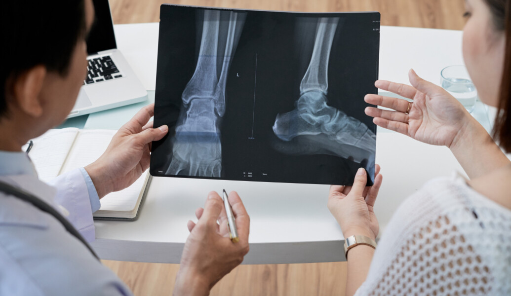 Пяточная шпора: что это, причины, как лечить? Пяточная шпора: что это, причины, как лечить?