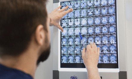 Neurologist consultation