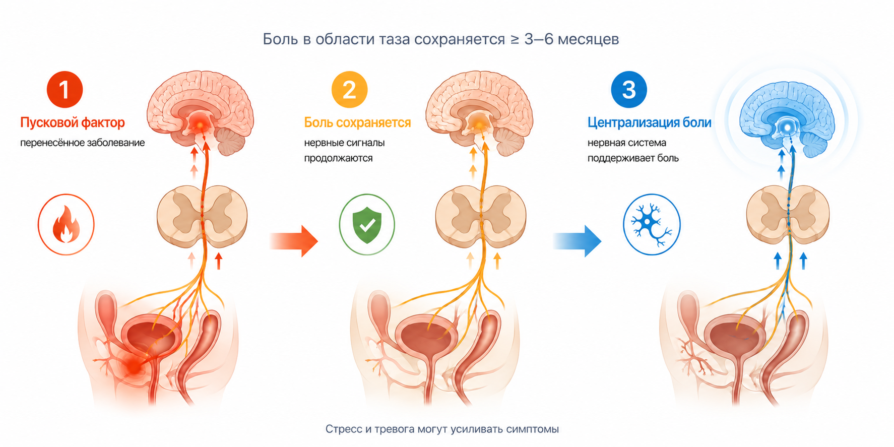 Этапы развития хронического тазового дискомфорта