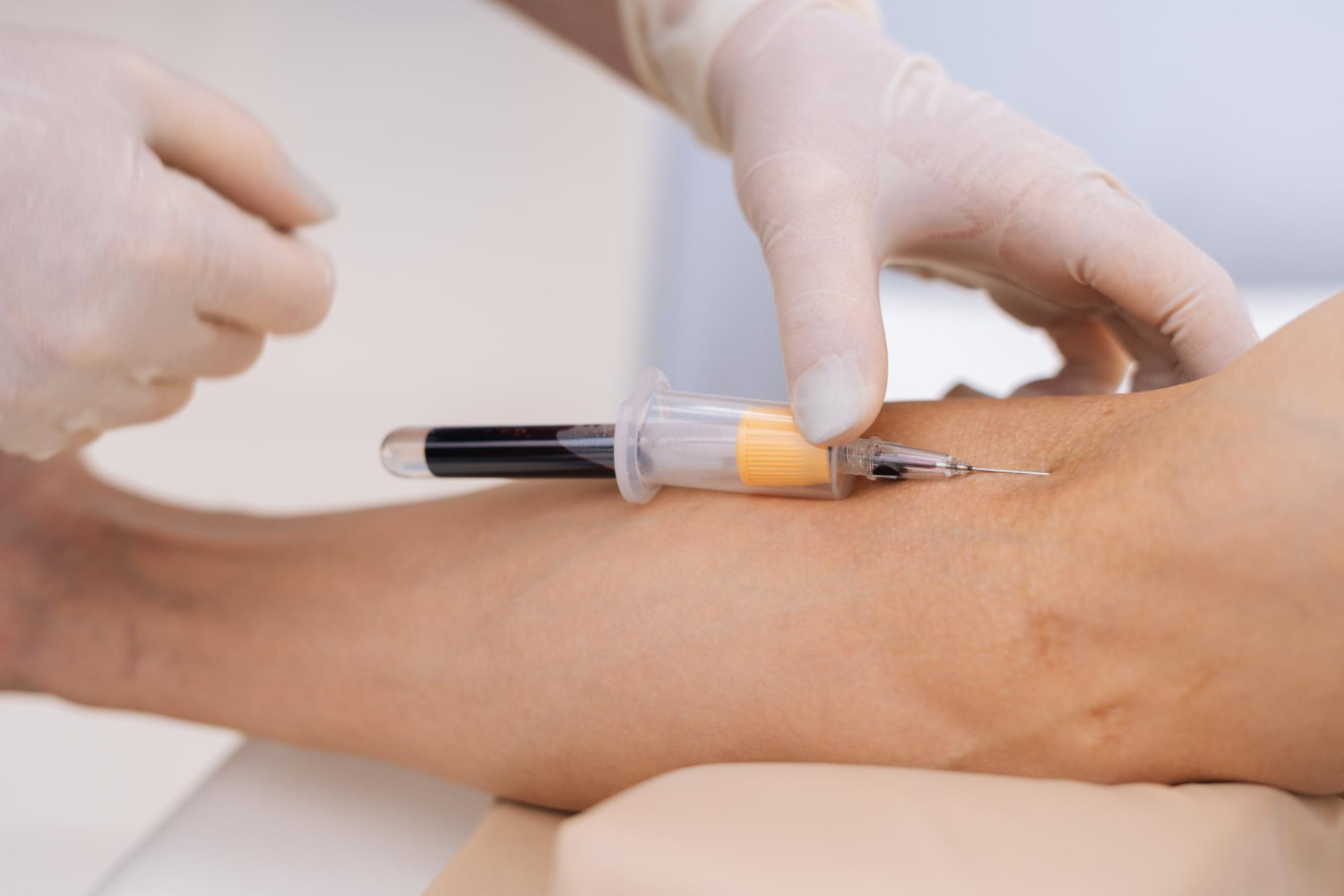 Как происходит подготовка к плазмолифтингу суставов? - Центр боли Справно