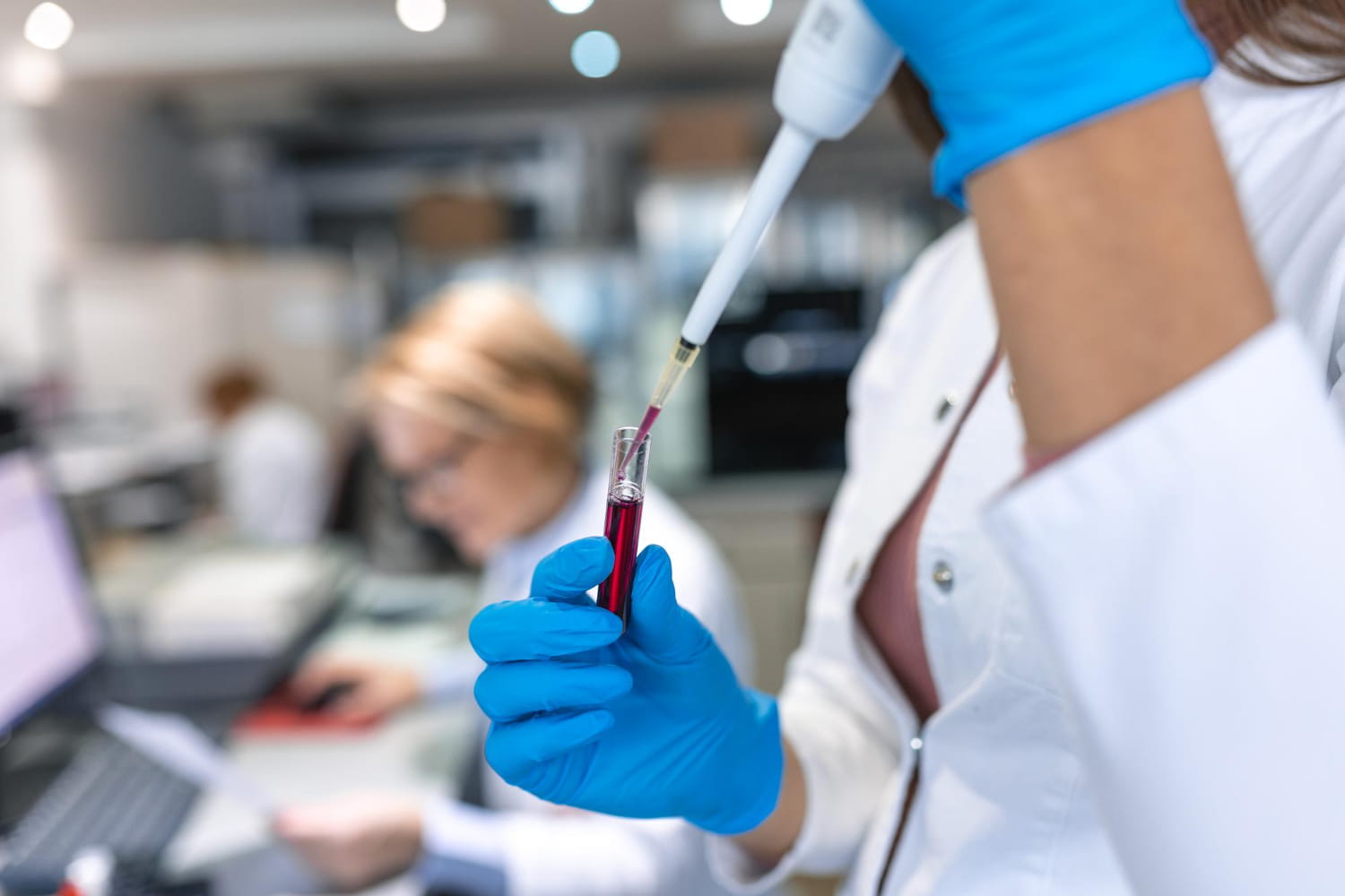 Как подготовиться к сдаче анализа на ферритин? - Центр боли Справно